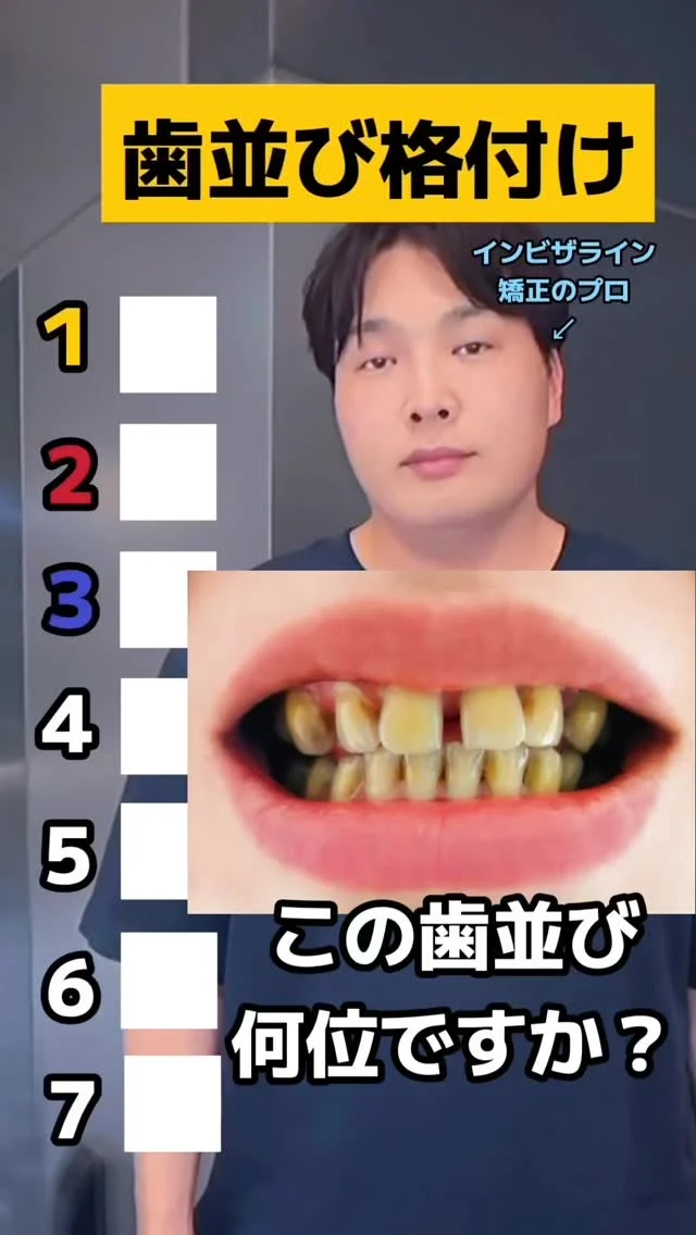 歯科医の辛口ランキング🔥
インビザ先生監修の失敗しないマウスピース矯正は月々¥2,100〜◎詳細はプロフィールのlitlinkをご覧ください💁‍♀️
#神戸矯正歯科 #ブラックダイヤモンドプロバイダー #マウスピース矯正