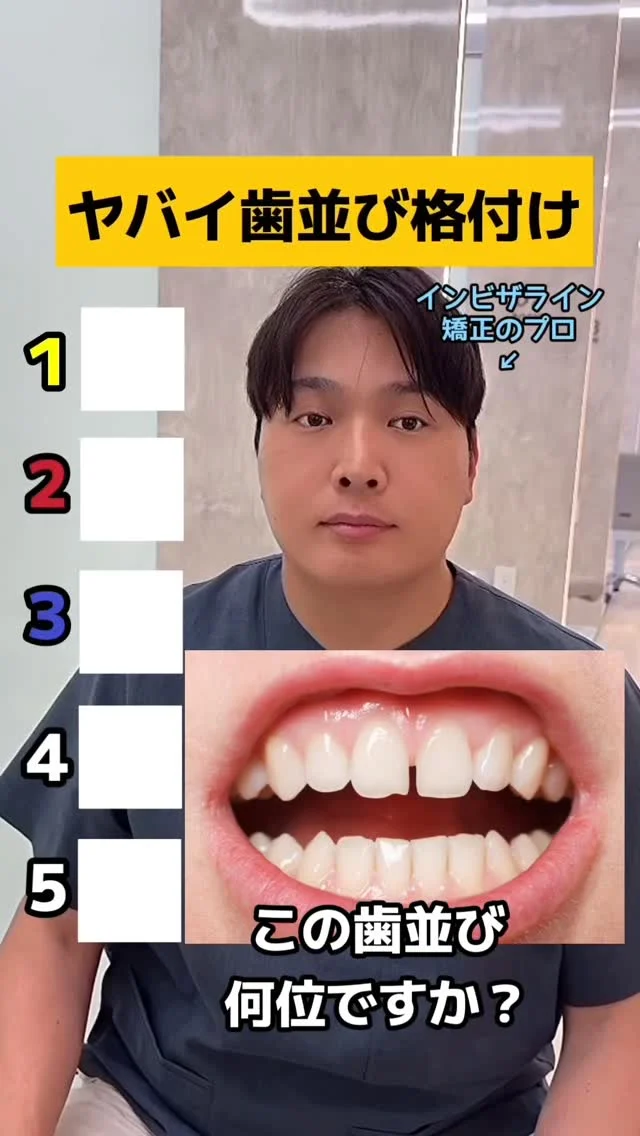 失敗しないマウスピース矯正なら、医療法人Miraiへお任せください◎部分矯正から抜歯症例や難症例まで対応可能です🙆‍♀️治療計画は全て西日本最多の治療実績を誇る、インビザライン社公認講師のDr.山﨑圭一が担当いたします。
症例写真👉@mirai_kyosei

#神戸矯正歯科 #堺矯正歯科 #マウスピース矯正