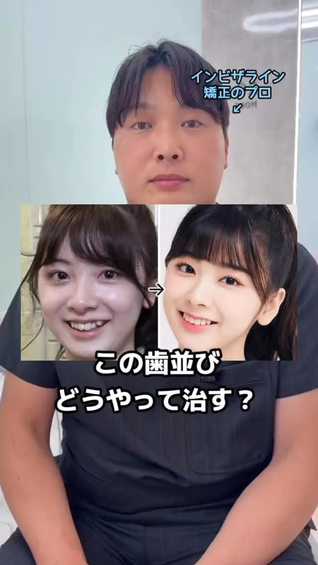 歯科医の辛口診断🔥
インビザ先生監修の失敗しないマウスピース矯正は月々
¥2,100～◎詳細はプロフィールのlitlinkをご覧ください🦷
#マウスピース矯正 #神戸矯正歯科 #堺矯正歯科