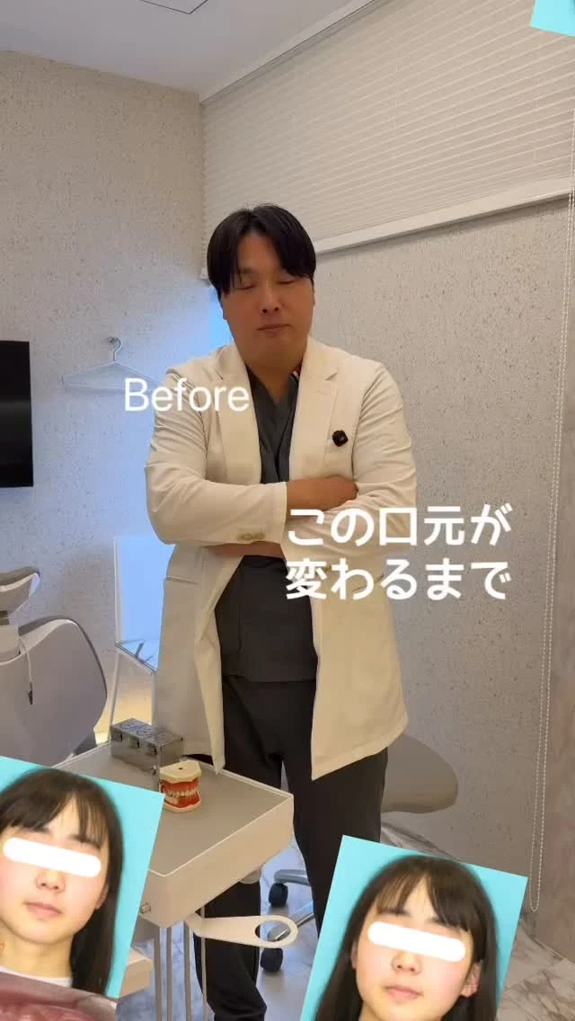 神戸大阪でインビザライン矯正なら、Dr.山﨑へ✨
他院でお断りされた重度の歯並びも対応可能です。

【Dr.山﨑の矯正認定実績 一覧】
▪︎TOPプロバイダー
▪︎インビザライン公認講師
▪︎ブラックダイヤモンドPV
▪︎PBMグローバルスピーカー

#マウスピース矯正 #神戸矯正歯科 #堺矯正歯科