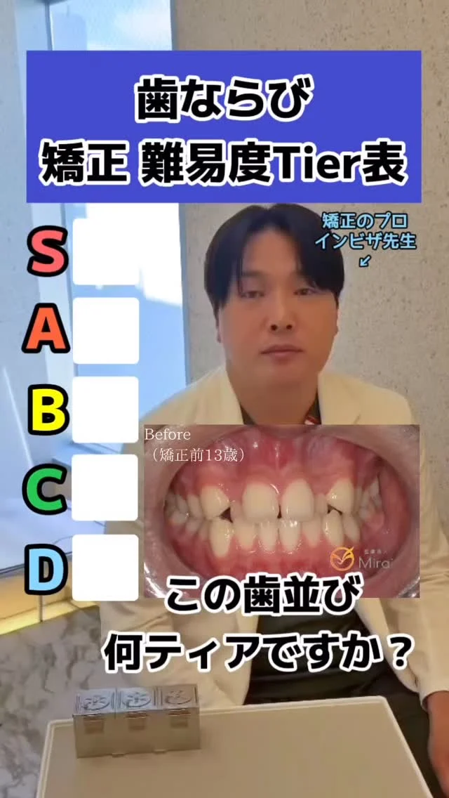 歯科医の辛口ランキング🔥
インビザ先生監修の失敗しないマウスピース矯正は月々¥2,100〜◎詳細はプロフィールのlitlinkをご覧ください💁‍♀️

S:25歳上下顎叢生と上顎前突に対する非抜歯矯正1年3ヶ月

A:13歳上下顎叢生に対する非抜歯矯正1年4ヶ月

B:21歳前歯部開咬空隙歯列に対する非抜歯矯正1年2ヶ月

C:41歳上下顎重度叢生に対する上下顎両側第一小臼歯抜歯矯正2年3ヶ月

D:24歳上下顎重度叢生に対する第一小臼歯抜歯矯正1年3ヶ月

#神戸矯正歯科 #ブラックダイヤモンドプロバイダー #マウスピース矯正